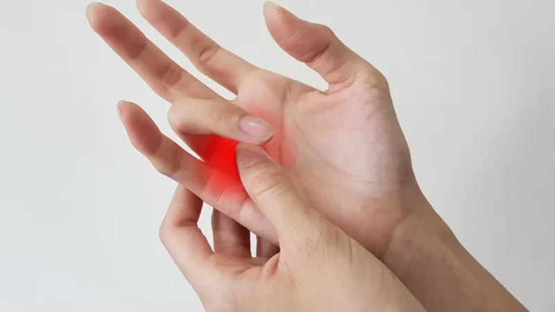 Trigger Finger Treatment: Easy Guide for Busy Moms